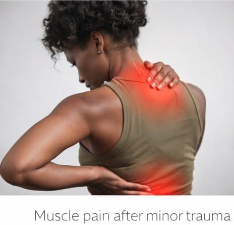 Buy Carisoprodol online Muscle Pain After Minor Trauma