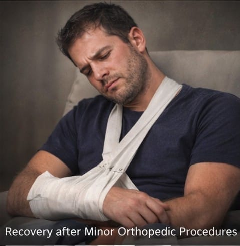 Carisoprodol for Minor Orthopedic Procedures